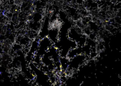 A protein receptor that exists in the smallest blood vessels of our body, called the microvasculature, has been linked to brain disorders such as Alzheimer’s, Parkinson’s, and stroke.  Virginia Tech scientists with the Fralin Biomedical Research Institute have discovered that a smaller version of this molecule (highlighted in blue) is present in healthy tissue as well, which could lead to a new understanding of its role in targeted approaches to prevent and treat a variety of health issues.