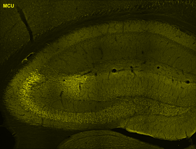 Magnified microscopic image